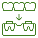 dental-bridge