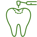 dental-bridge